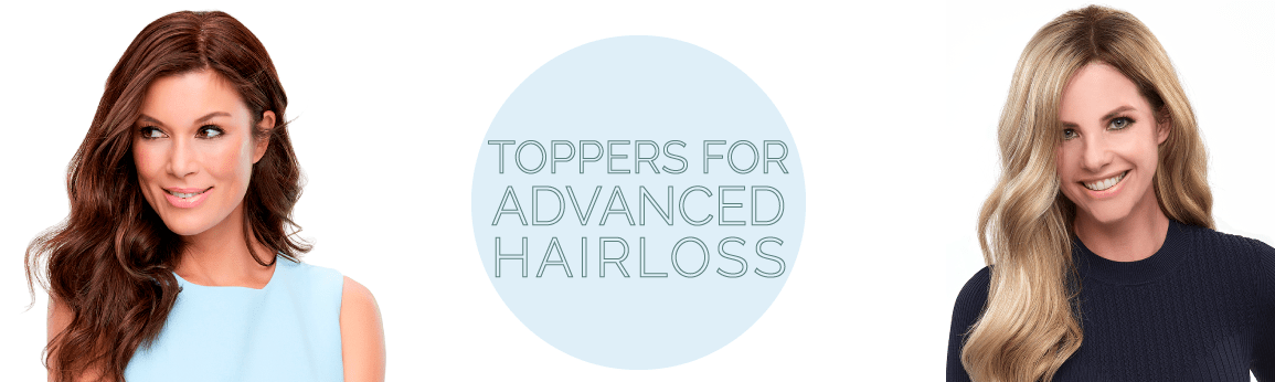 Toppers for Advanced Hairloss